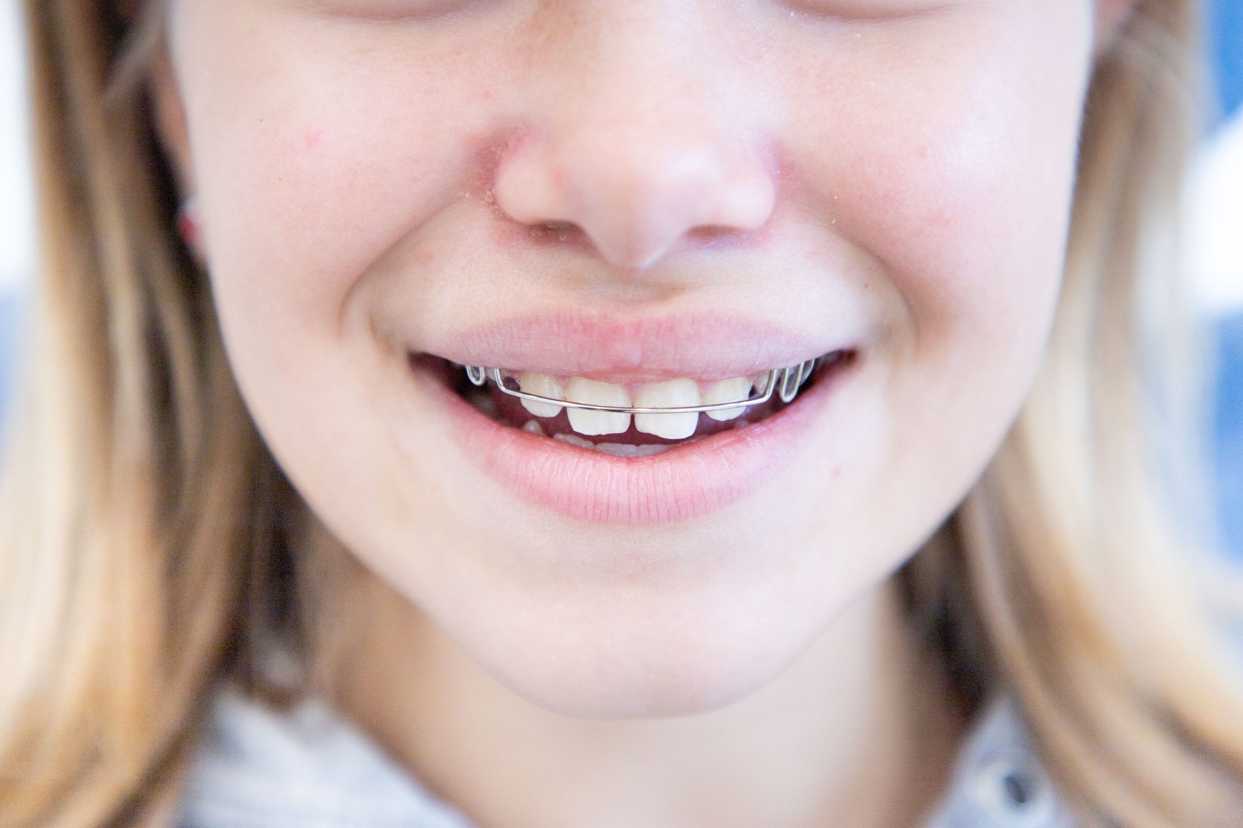 ortodont-bvdentalsolutions